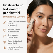 Reskyn Recovery Stick™ — Stick al silicone di grado medicale per cicatrici